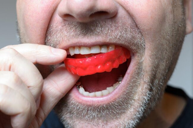 Digital Smile Designer
